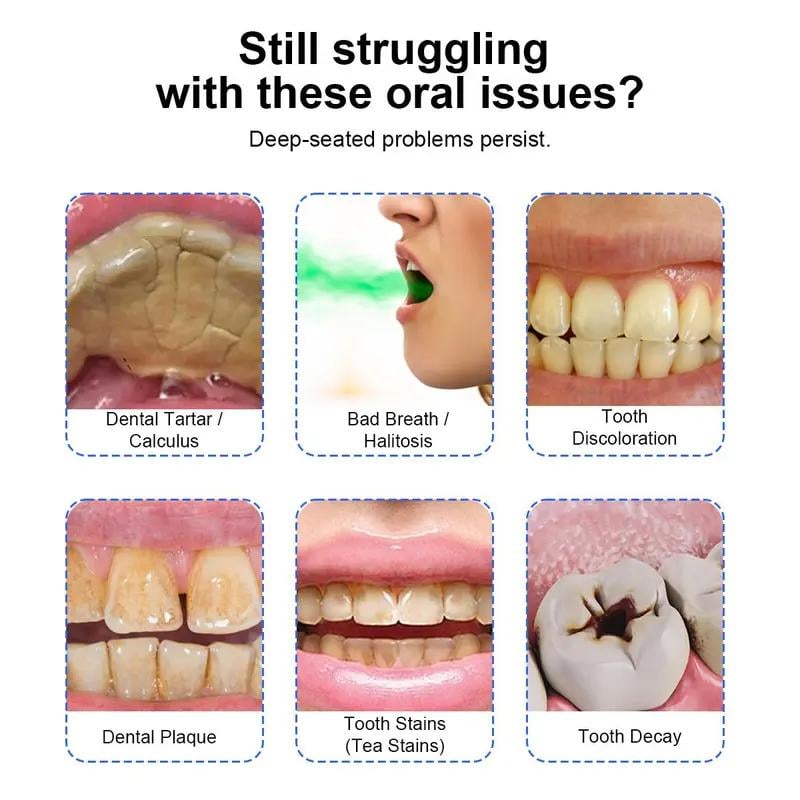 Electric Scaler with Effective Remove Plaque Tartar